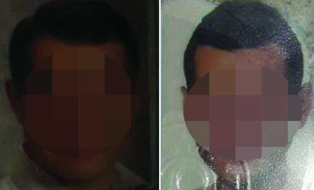 Çorlu'da Kaza; 2 Ölü 2 Yaralı