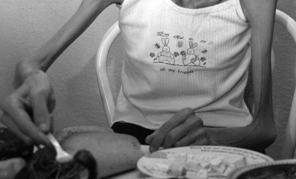 'anoreksiya Sonu Ölümle Bitebilen Bir Hastalıktır'