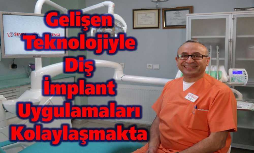 Gelişen Teknolojiyle Diş İmplant Uygulamaları Kolaylaşmakta