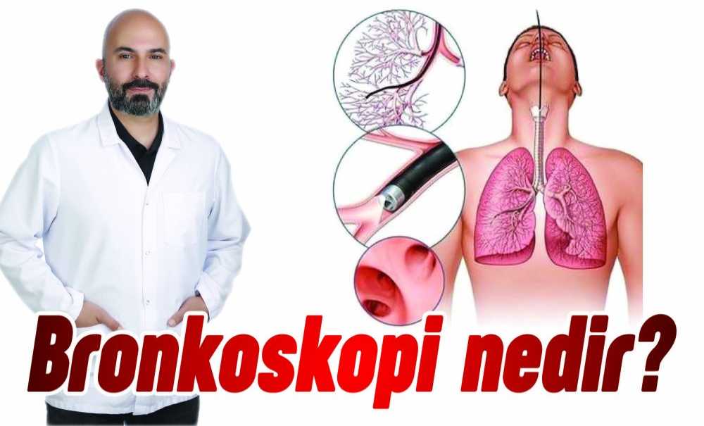 Bronkoskopi Nedir?